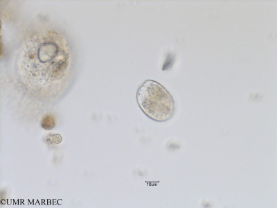 phyto/Bizerte/bizerte_lagoon/RISCO November 2015/Prorocentrum mexicanum (Lagune_T1_B_cf Prorocentrum lima-2).tif(copy)_thumb.jpg